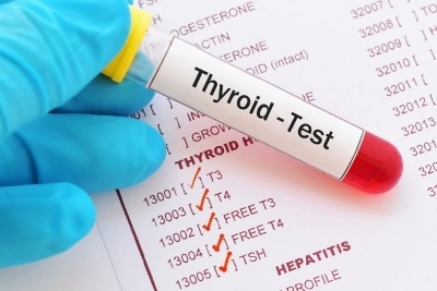 Hormoni - analiza hormona štitne žlezde T3,T4 i TSH na tri lokacije - Zemun, Slavija i Surčin