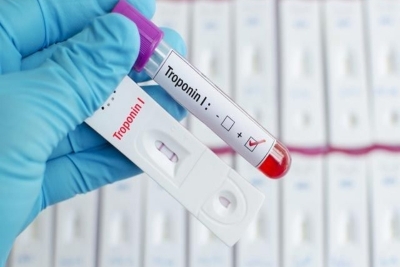 Test na prisustvo Helicobacter pylori i okultno krvarenje u stolici za 1000 din